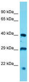 Ubiquitin Specific Peptidase 12 antibody, TA333885, Origene, Western Blot image 
