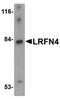 Leucine Rich Repeat And Fibronectin Type III Domain Containing 4 antibody, orb75163, Biorbyt, Western Blot image 