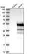 G Kinase Anchoring Protein 1 antibody, NBP1-84669, Novus Biologicals, Western Blot image 