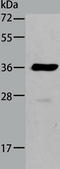 Aldo-Keto Reductase Family 1 Member B10 antibody, TA321874, Origene, Western Blot image 