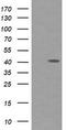 Parvin Alpha antibody, TA505999S, Origene, Western Blot image 