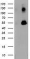 Sequestosome 1 antibody, CF502128, Origene, Western Blot image 