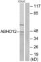 Monoacylglycerol lipase ABHD12 antibody, LS-B9740, Lifespan Biosciences, Western Blot image 