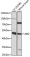 Abl Interactor 2 antibody, 15-821, ProSci, Western Blot image 