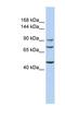 Polypeptide N-Acetylgalactosaminyltransferase 5 antibody, NBP1-62372, Novus Biologicals, Western Blot image 