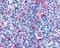Cysteinyl Leukotriene Receptor 1 antibody, NLS1320, Novus Biologicals, Immunohistochemistry frozen image 