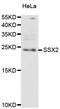 SSX Family Member 2B antibody, A12258, Boster Biological Technology, Western Blot image 