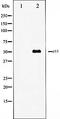 Serine/Threonine Kinase 11 antibody, orb99169, Biorbyt, Western Blot image 
