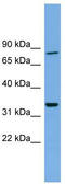 DDHD Domain Containing 2 antibody, TA333835, Origene, Western Blot image 