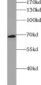 Very long-chain acyl-CoA synthetase antibody, FNab07948, FineTest, Western Blot image 