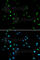Histone Deacetylase 4 antibody, A0239, ABclonal Technology, Immunofluorescence image 