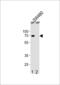 ETS Variant 5 antibody, LS-C167846, Lifespan Biosciences, Western Blot image 
