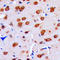 Dual specificity protein phosphatase 16 antibody, LS-C353573, Lifespan Biosciences, Immunohistochemistry paraffin image 