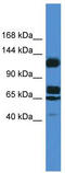 Suppression Of Tumorigenicity 5 antibody, TA342933, Origene, Western Blot image 