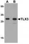 T Cell Leukemia Homeobox 3 antibody, TA319908, Origene, Western Blot image 