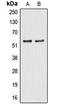 Aldehyde dehydrogenase, mitochondrial antibody, LS-C351814, Lifespan Biosciences, Western Blot image 