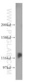 DEAD-Box Helicase 24 antibody, 15769-1-AP, Proteintech Group, Western Blot image 