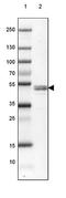 Reticulocalbin 2 antibody, NBP2-32010, Novus Biologicals, Western Blot image 