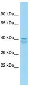 Family With Sequence Similarity 81 Member A antibody, TA338857, Origene, Western Blot image 