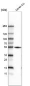 Tuj1 antibody, AMAb91395, Atlas Antibodies, Western Blot image 