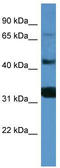 Melanotransferrin antibody, TA342916, Origene, Western Blot image 