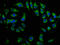 Iodothyronine Deiodinase 2 antibody, LS-C671307, Lifespan Biosciences, Immunofluorescence image 