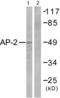 Transcription Factor AP-2 Alpha antibody, abx013021, Abbexa, Western Blot image 