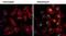 Mitogen-Activated Protein Kinase 8 antibody, MA5-15228, Invitrogen Antibodies, Immunofluorescence image 