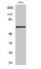 AarF Domain Containing Kinase 5 antibody, STJ91488, St John