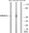 Armadillo Repeat Containing 6 antibody, LS-C119740, Lifespan Biosciences, Western Blot image 