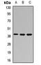 Pre T Cell Antigen Receptor Alpha antibody, LS-C669004, Lifespan Biosciences, Western Blot image 