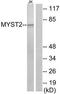 Histone acetyltransferase MYST2 antibody, TA312332, Origene, Western Blot image 