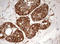 Mitochondrial Ribosomal Protein S11 antibody, LS-C789687, Lifespan Biosciences, Immunohistochemistry paraffin image 