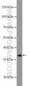 Pac-1 antibody, 27327-1-AP, Proteintech Group, Western Blot image 