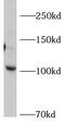 Adaptor Related Protein Complex 2 Subunit Alpha 2 antibody, FNab00461, FineTest, Western Blot image 