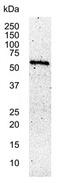 c-Myc antibody, MCA2200, Bio-Rad (formerly AbD Serotec) , Immunohistochemistry paraffin image 
