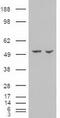 Amylase Alpha 2A (Pancreatic) antibody, LS-C784119, Lifespan Biosciences, Western Blot image 