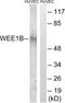 WEE1 Homolog 2 antibody, PA5-39533, Invitrogen Antibodies, Western Blot image 
