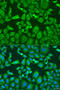 Kinesin Family Member 11 antibody, 23-271, ProSci, Immunofluorescence image 
