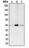 Bone Morphogenetic Protein 2 antibody, LS-C351876, Lifespan Biosciences, Western Blot image 