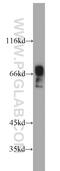 Zinc finger protein 496 antibody, 20900-1-AP, Proteintech Group, Western Blot image 