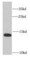 Ribosomal Protein S12 antibody, FNab07458, FineTest, Western Blot image 