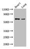 DDB1 And CUL4 Associated Factor 8 antibody, LS-C677653, Lifespan Biosciences, Western Blot image 