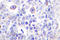 CD83 Molecule antibody, LS-C176864, Lifespan Biosciences, Immunohistochemistry frozen image 