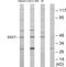 SS18 Subunit Of BAF Chromatin Remodeling Complex antibody, GTX87692, GeneTex, Western Blot image 