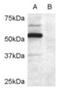 Doublecortin Domain Containing 2 antibody, orb19169, Biorbyt, Western Blot image 