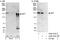 Zinc Finger E-Box Binding Homeobox 2 antibody, A302-474A, Bethyl Labs, Immunoprecipitation image 