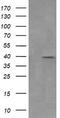 Mitogen-Activated Protein Kinase Kinase 3 antibody, TA505672S, Origene, Western Blot image 