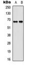 DEAD-Box Helicase 55 antibody, LS-C358466, Lifespan Biosciences, Western Blot image 