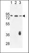Coagulation Factor XII antibody, PA5-26672, Invitrogen Antibodies, Western Blot image 